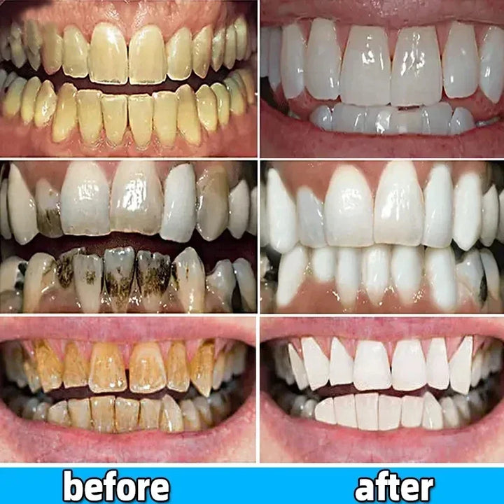 Dental Calculus Remover Toothpaste For Brightening Care