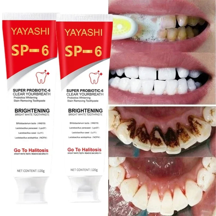 Probiotic Toothpaste SP-6 Whitening Tooth Stain Remover 120g